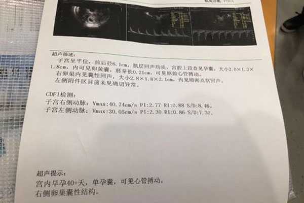 香港验血在香港法律允许吗,泰国试管婴儿移植后，HCG如何避免怀孕？
