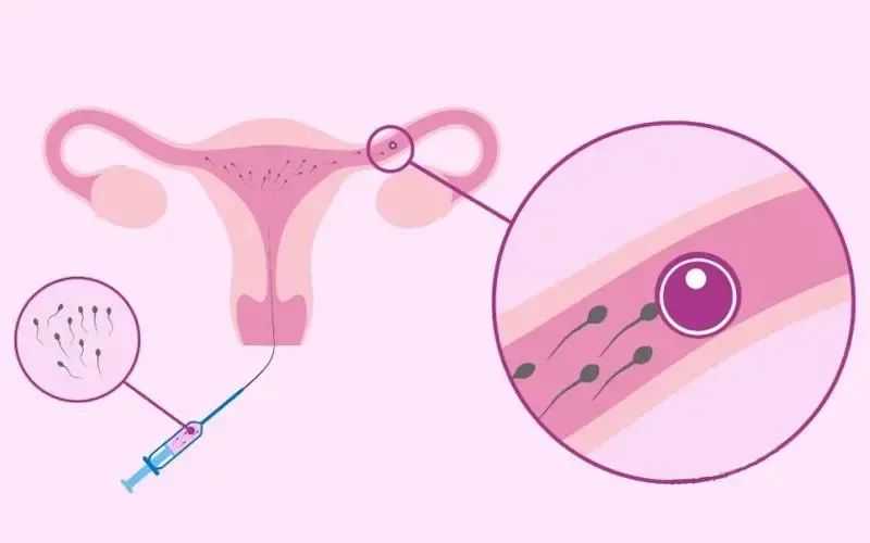 香港验血测胎儿合法吗,湖北可以做三代试管婴儿助孕的辅助生殖医院有哪些？
