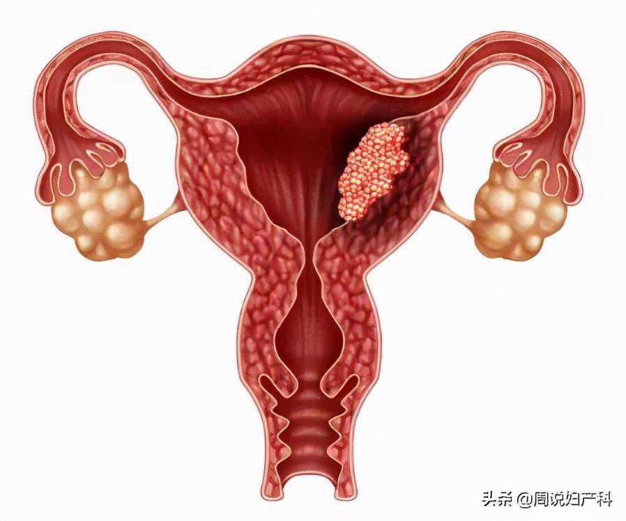 香港验血16组有多少阳性是儿子,月经期的子宫内膜厚度多少正常