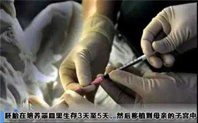 香港验血非法行医罪,女性做试管婴儿疼不疼？