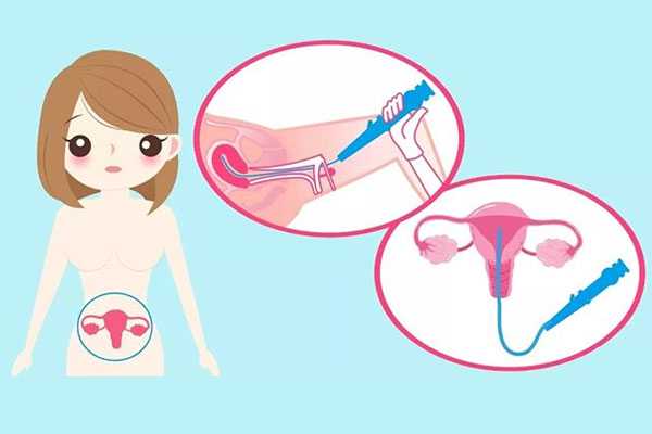 香港验血测男女途径,第三代试管取卵后内膜怎么调理？