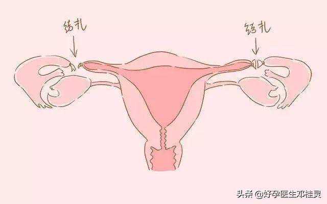 香港验血中心有哪些项目,备孕科普：输卵管结扎后又想要孩子，怎样做能快速