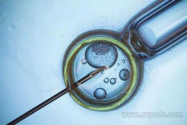 香港验血测男女权威机构,试管婴儿长方案是什么有哪些阶段