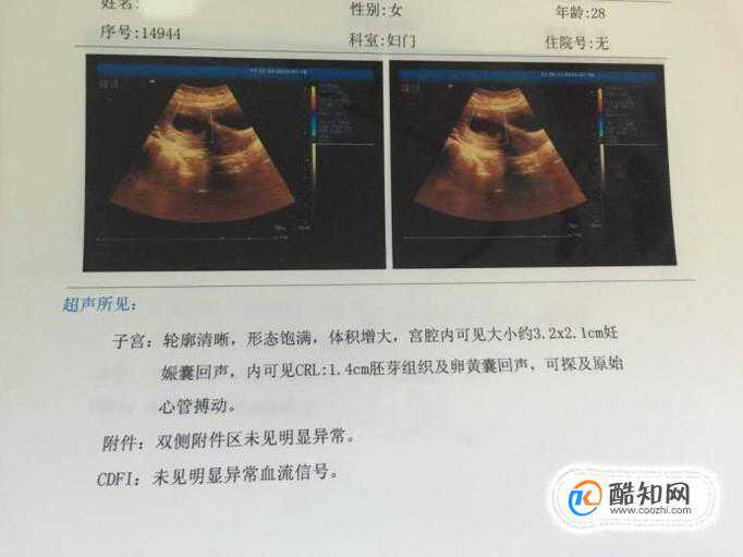 怀孕40天验血香港-香港验血查男女准确率