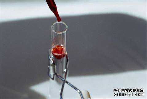 香港验血孕妇违法吗_香港抽血测宝宝男女可不牢靠？期望能够提示到你