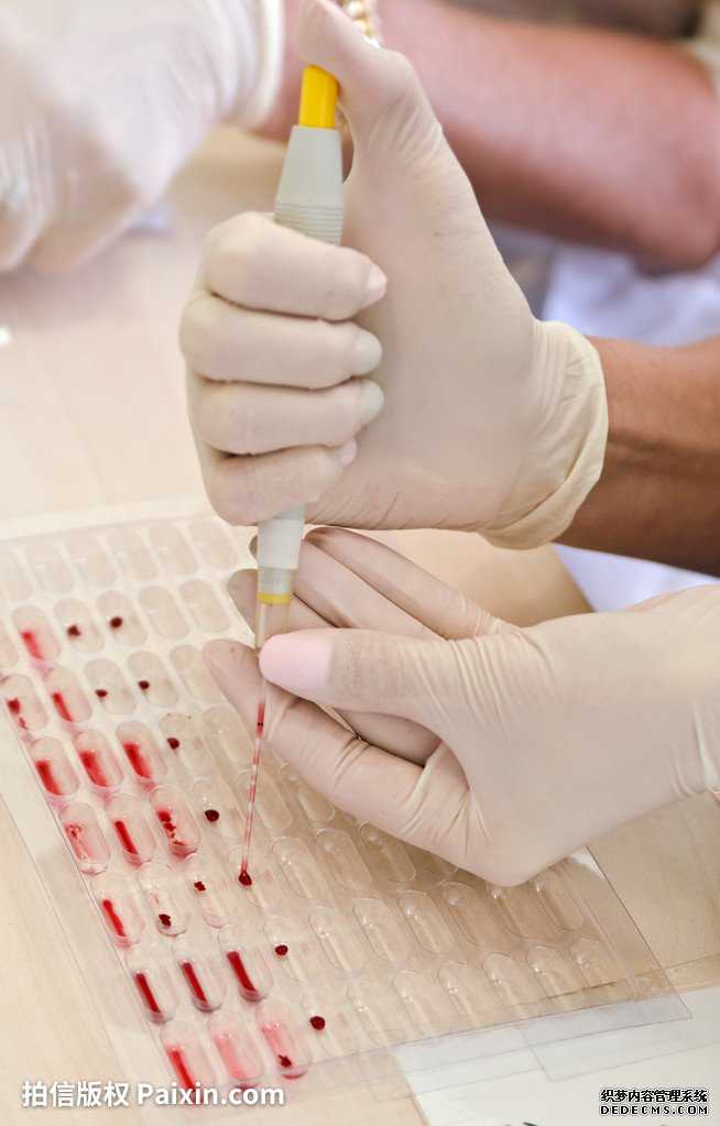香港验血的管多少钱_精确的性别鉴定中心查验保证