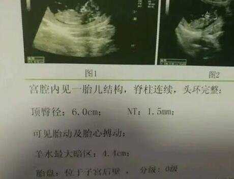 香港邮寄验血中介_怀孕到香港去验血怎么弄准不准_性别鉴定详细流程说明
