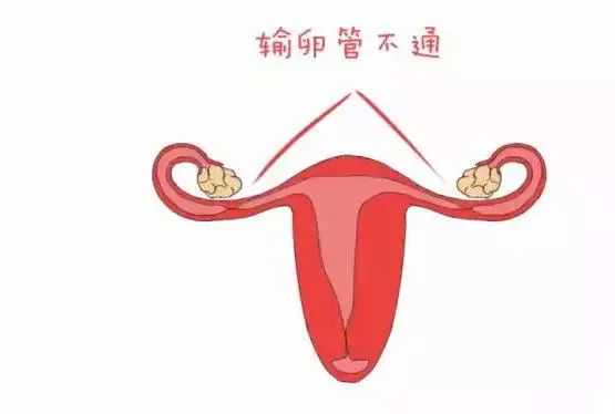 香港验血查男女怎么检查的,amh0.01fsh30还能自然怀孕吗能做试管吗